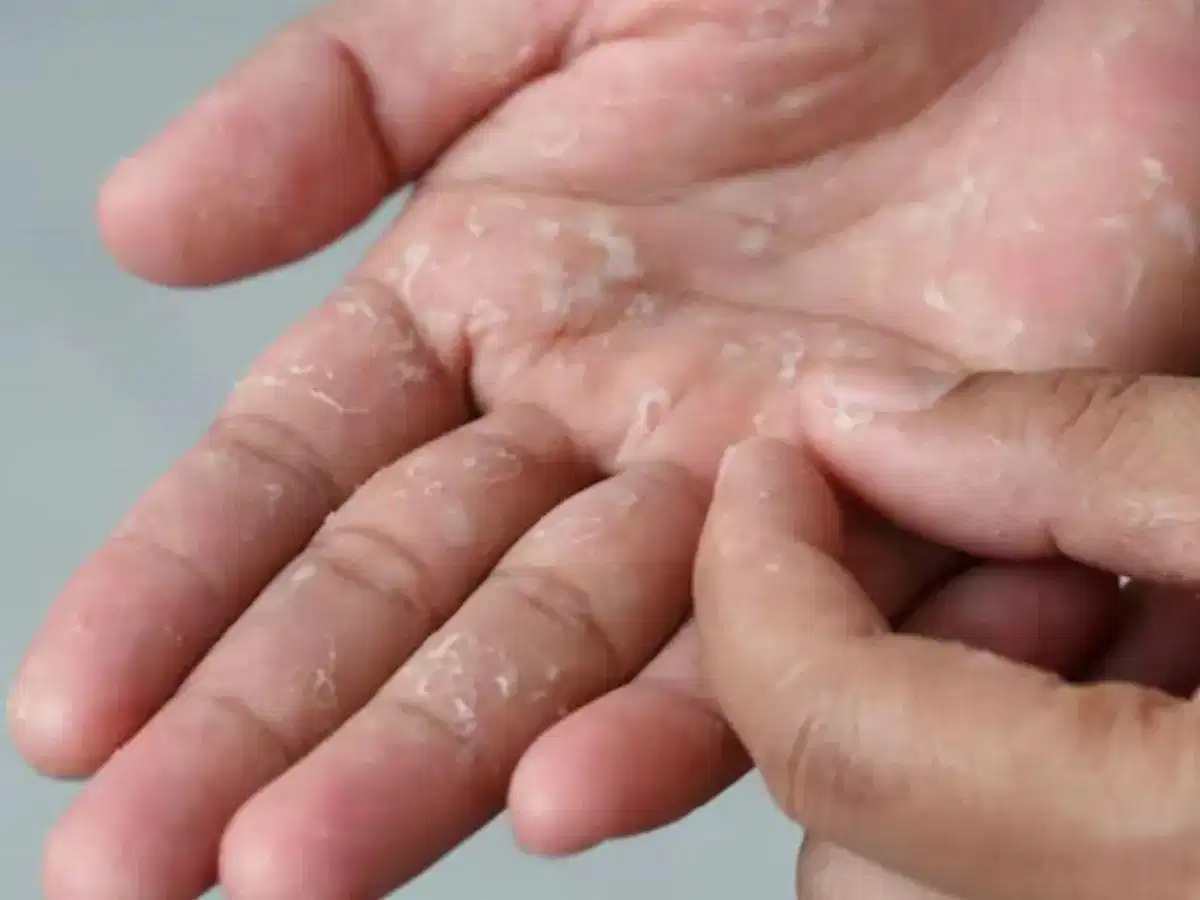 Da khô có thể liên quan đến một số bệnh lý