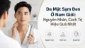 Da Mặt Sạm Đen Ở Nam Giới: Nguyên Nhân Và Cách Trị Hiệu Quả