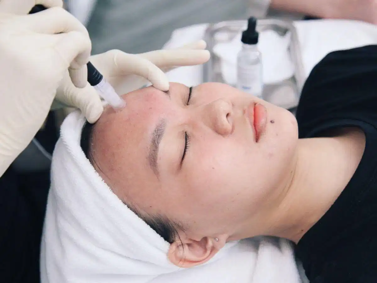 Giải đáp thắc mắc về chăm sóc da sau khi nặn mụn