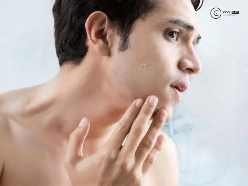 Phòng ngừa râu mọc ngược Thay đổi thói quen chăm sóc da là phương pháp phòng ngừa hiệu quả nhất