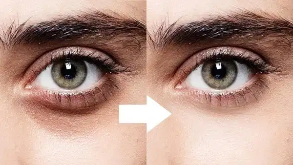 Kem mắt RoC Retinol Correxion cải thiện nếp nhăn và quầng thâm