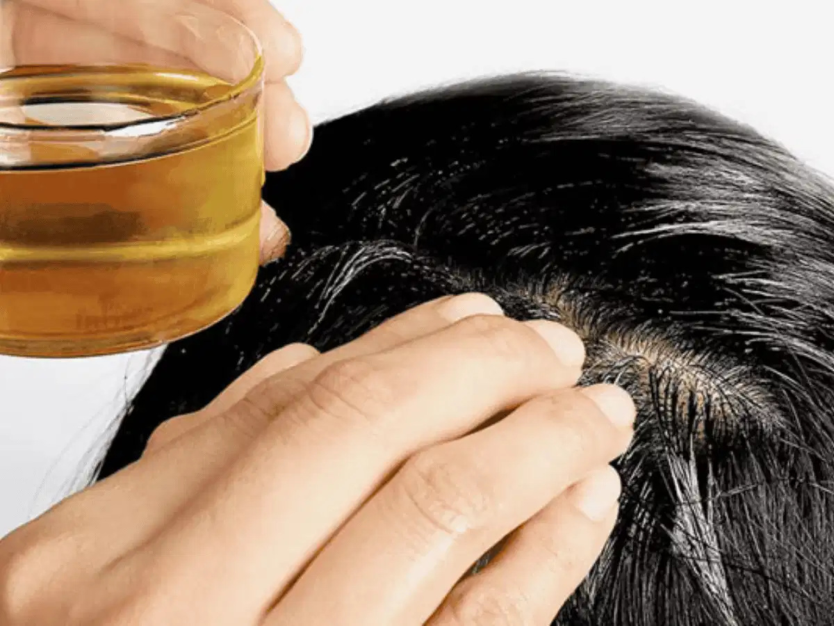 Lưu ý khi trị nấm da đầu bằng lá trầu không Những lưu ý khi dùng lá trầu không chăm sóc da đầu
