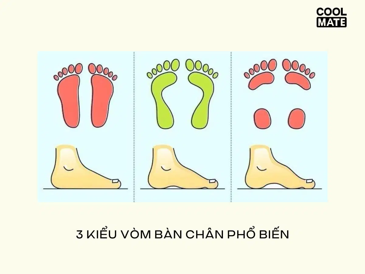 Tùy kiểu vòm bàn chân để chọn giày chạy phù hợp Tùy kiểu vòm bàn chân để chọn giày chạy phù hợp